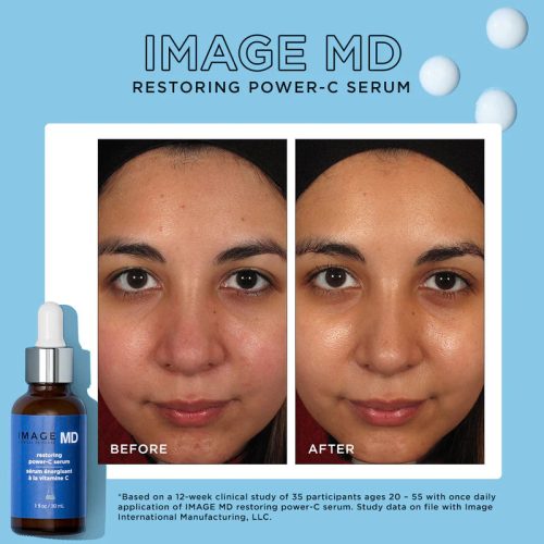 IMAGE MD RESTORING POWER C SERUM PDP R08 800x c83e78ed 1bbc 4950 8130 e03308b2f544