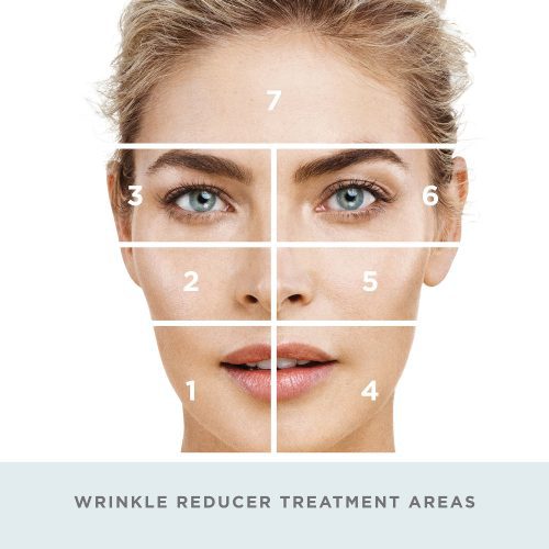 nuface trinity wrinkle reducer treatment